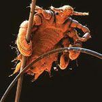 Nit Picking (Head Lice)